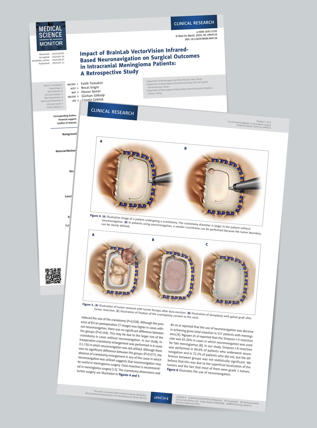 Impact of BrainLab VectorVision Infrared Based Neuronavigation on Surgical Outcomes  in Intracranial Meningioma Patients:  A Retrospective Study
