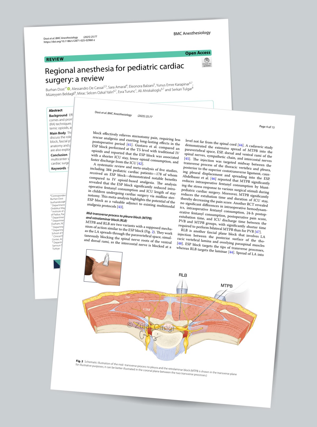 Regional Anesthesia for Pediatric Cardiac Surgery: A Review